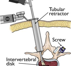 Spinal Surgeon Cape ...